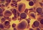 Understanding the rise of leukemia