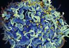 Second patient free of HIV after undifferentiated organism treatment
